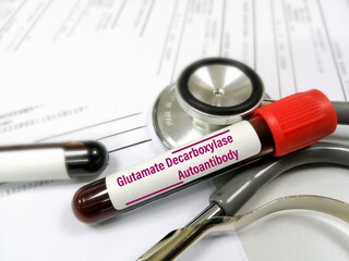 Blood sample for Glutamic acid decarboxylase antibody (GADA) test. Pancreatic islet antibody and an important serological marker of predisposition to type 1 diabetes.