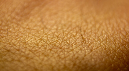 Macro human skin texture. Closeup skin pattern. Medicine healthy surface background. Dermatitis concept