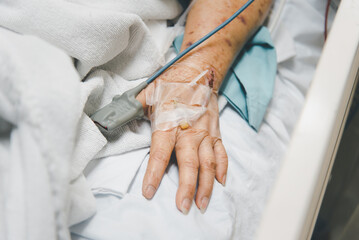 Patient in the hospital with pulse gauge on finger