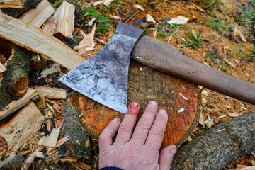 Cutting wood with a hand ax and injuring a hand.