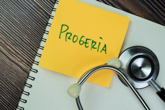 Concept of Progeria write on sticky notes with stethoscope isolated on Wooden Table.