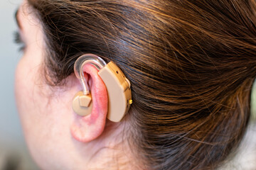 Young woman wearing a hearing aid. World hearing day concept.