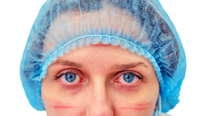 Doctor face with traces and wounds from a medical mask, stay home, isolated on a white background. Woman nurse on a with cuts from protective clothing, close-up.