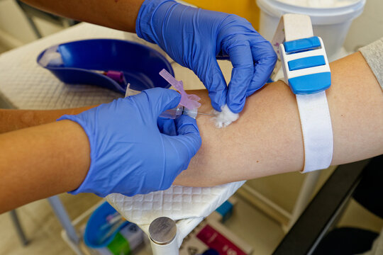 Blood drawn from a young, female patient, showing her arm and the needle being used to access the vein.