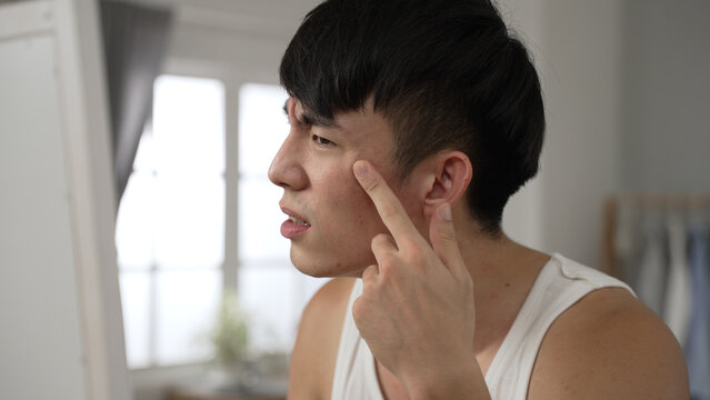 closeup view of an upset asian young man discovering pimple on face and trying to get rid of it in front of the mirror in the morning at his bed chamber.