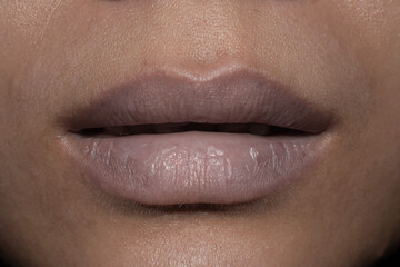 Pale lips of Asian sick woman. Sign of anaemia.  - obrazy, fototapety, plakaty