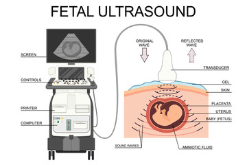 Fetal ultrasound illustration. Medical poster. Pregnancy ultrasound picture. Baby in the womb. Little embryo silhouette. Pregnant woman clinic examination. Vector human embryo.