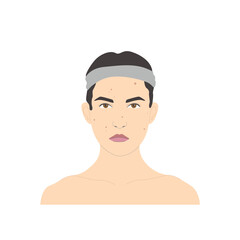 Cosmetic face care, sad woman with pimples, rash or acne, vector isolated on white background.