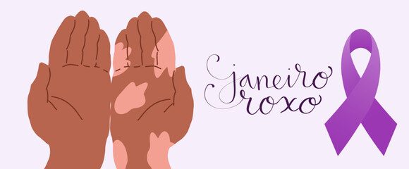 Purple January in portuguese Janeiro Roxo, Brazil campaign for hansen disease awareness banner. Handwritten calligraphy lettering. Human hand with white patches on skin illustration vector