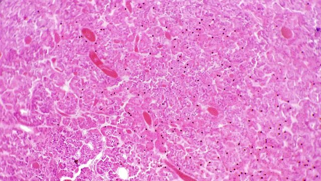 Human pituitary gland in cross section filmed under microscope with 100x magnification for medical issues. Study of people endocrine system enlarging organs in lab. Research of brain and its parts