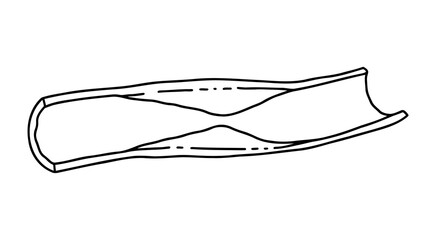 A narrowed blood vessel in a person. Illustration about coronary artery disease.