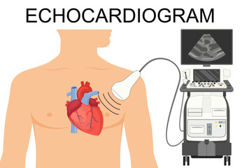 Echocardiogram. Heart ultrasound.  Medical Vector illustration of Echocardiogram for articles, posters, banners.  Cardiology Echo test. Diagnose cardiac problem. Preventing, diagnosing a heart attack.