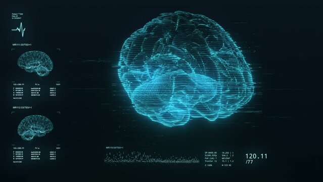 3D Brain scan visualization footage. The device scans and displays vital signs on the screen. Neurology data analysis process. Diagnosis of disease. Futuristic MRI video. 4K Medical animation