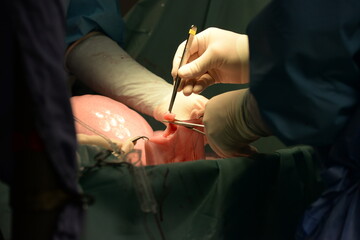 Kolik Operation beim Pferd, Details