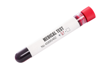 Single blood test tube with sample generic text on the sticker isolated on a transparent background