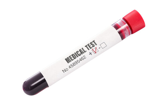Single blood test tube with  sample generic text on the sticker isolated on a transparent background