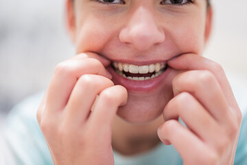 Teenager boy wear simulator orthodontic silicone invisible leveling braces for teeth.  Dental...