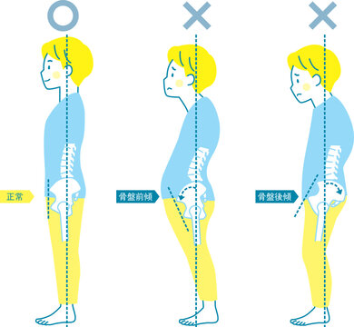 男性の良い姿勢と悪い姿勢の見本_骨盤