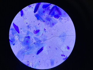 Microscopic view of Malassezia pachydermatis cells taken from dog with ear infecion