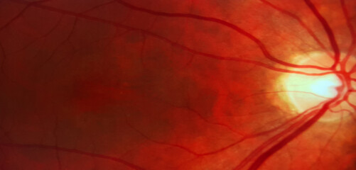 a retinal photo image inside the eye