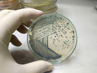 Bacteria colony of Escherichia coli (E.coli) in culture media plate.