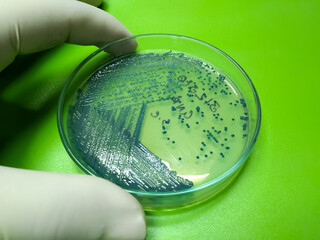 HiCrome UTI Agar media pure growth of Escherichia coli or E.coli bacteria at medical microbiology...
