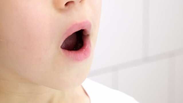 A child shows his loose milk tooth and pushes it with his tongue. Open mouth close-up. Caucasian 6 year old kid in a white T-shirt on a white bathroom background. lower incisor. Copy space. Body part.