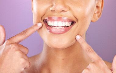 Naklejka premium Happy woman, face or dental care on purple studio background or teeth whitening, invisible braces treatment or grooming. Zoom on beauty model smile or cosmetic mouth hygiene and healthcare cleaning