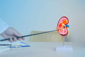 doctor nephrologist pointing at polycystic on a kidney mockup on his desktop