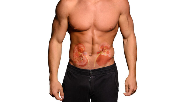 Beautiful and health athletic caucasian muscular young man with kidney hologram. Kidney disease, stones - Powered by Adobe