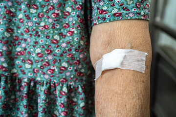 Asian senior or elderly old lady woman patient show cotton wool stop bleeding, after blood drawing testing for annually physical health check up to check cholesterol, blood pressure, and sugar level.