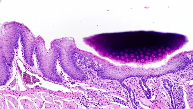 Palatine tonsil of human being filmed under microscope magnified in 200 times for medical issues on bright field. Studying diseases and affected organs of the oral cavity. Research of people anatomy