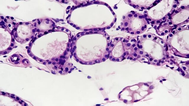 Parathyroid cells magnified in 400 times on white background for educational issues. Isolated macro of human endocrine organ taken for learning structure in laboratory. Anatomy and medicine theme