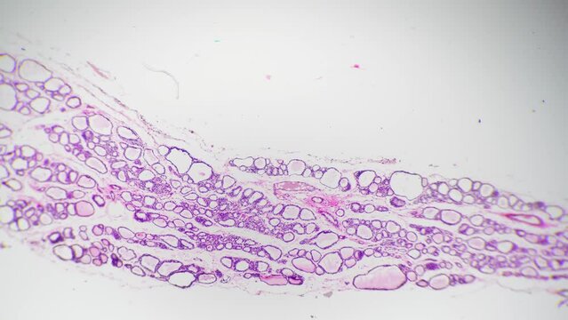Parathyroid glands of the human in high magnification 40x against white background. Isolated macro of small endocrine organs in the neck producing hormones for calcium amount regulation. Anatomy theme