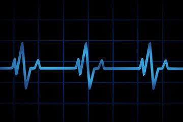 Vector illustration of heart rate and pulse graph