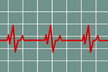 Vector illustration of heart rate and pulse graph