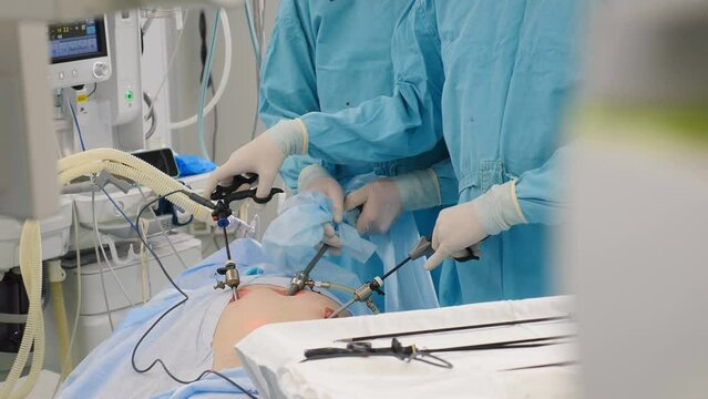 Laparoscopic cholecystectomy instrument. Real Surgery, abdominal incision, working with surgical laparoscopy instruments. Doctor hands in sterile gloves holding trocar for laparoscopy procedure. 4 k