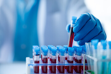 Lab assistant, a medical scientist, a chemistry researcher holds a glass tube through the blood...