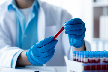 Lab assistant, a medical scientist, a chemistry researcher holds a glass tube through the blood...