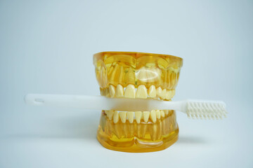 Dentures with a toothbrush on a white background.Upper and lower jaws with false teeth. Dentures or false teeth, close-up.