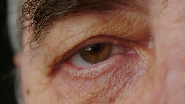 Thick eyebrows in an elderly man close-up. The face and eyes of an old man. Large wrinkles on the face of an elderly man. Face close up. A senior citizen looks into camera