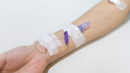Arm puncture for intravenous infusion or medication for hospitalized patients, Treatment of patients with intravenous injections to allow the patient to receive the drug directly.