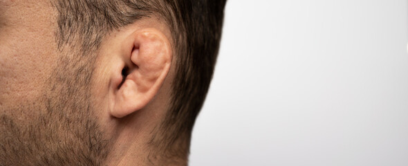 Cose-up photography of wrestler ear fracture.
