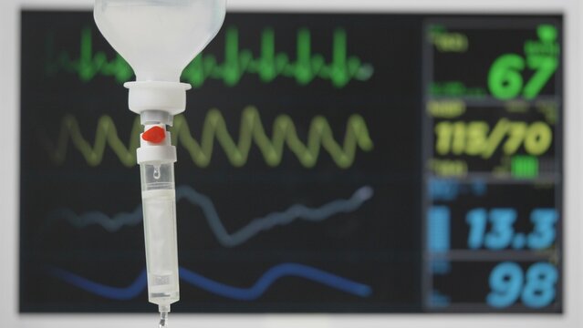 Detail of transfusion dropper and electrocardiograph of patient in hospital