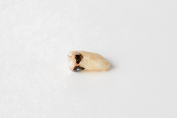 Extracted tooth close-up with caries and a whole root on a white isolated background.