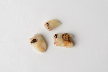 The concept of dental care, three extracted teeth with varying degrees of caries.