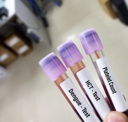 Close view of blood samples for dengue fever (Platelet, HCT, Dengue) test, dengue virus PCR test,...