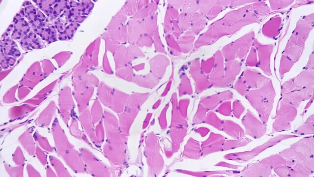 Human palatine tonsil under light micrograph magnified in 200 times for medical issuess against bright field. Studying diseases and affected organs of the oral cavity. Research of people anatomy
