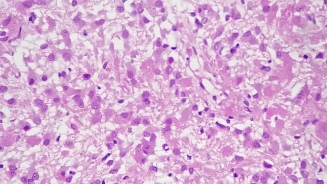 Human pineal body in section filmed under microscope with 400x magnification on white background. Macro view of small endocrine gland in the brain of people responsible for melatonin producing