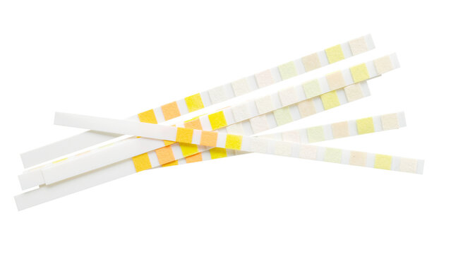 Ph or medical test strips. Isolated png with transparency
